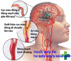 Top 10 Thuoc dieu tri tai bien mach mau nao hieu qua nhat