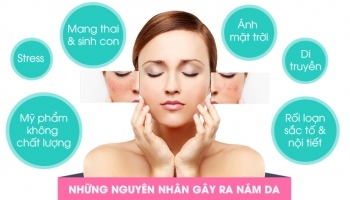 Top 8 Nguyen nhan gay ra nam da khien ban mat tu tin