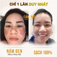 Top 5 Dia chi tri nam tot nhat Thanh Hoa
