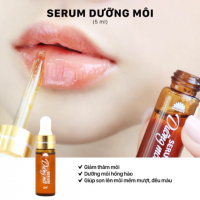 Top 4 Serum tri tham moi hieu qua nhat