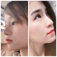Top 5 Dia chi nang mui S line dep va an toan nhat TP. HCM