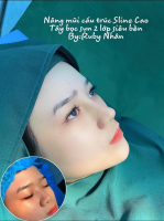 Top 8 Tham my vien uy tin va chat luong nhat TP. Quy Nhon Binh Dinh