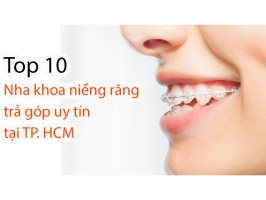 Top 10 Nha khoa nieng rang tra gop uy tin nhat TP. HCM