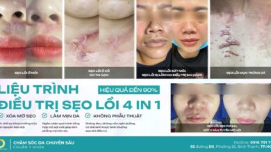 anh 1 tri seo loi 4 in 1